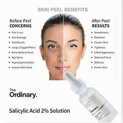 The Ordinary Salicylic Acid 2% Solution